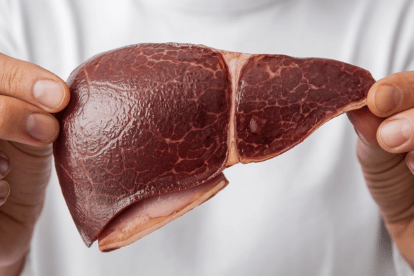 Is it Possible to Reverse Fatty Liver Disease